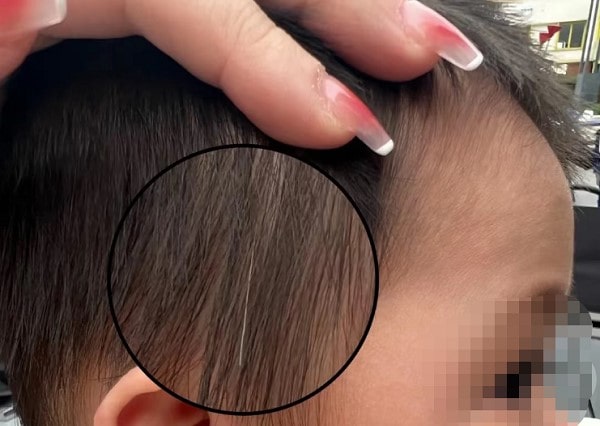 Trẻ Em Bị Tóc Bạc Sớm Là Bệnh Gì? 3 Trẻ Em Bị Tóc Bạc Sớm Là Bệnh Gì? 2