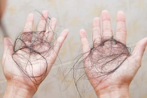 1 Ngày Rụng Bao Nhiêu Sợi Tóc Là Bình Thường? 15 1 Ngày Rụng Bao Nhiêu Sợi Tóc Là Bình Thường?
