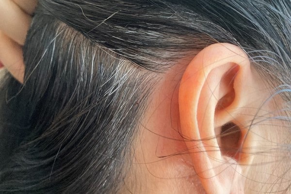 Tóc Bạc Sớm Ở Tuổi 14: Nguyên Nhân, Cách Ngăn Ngừa Và Giải Pháp 29 Tóc Bạc Sớm Ở Tuổi 14: Nguyên Nhân, Cách Ngăn Ngừa Và Giải Pháp