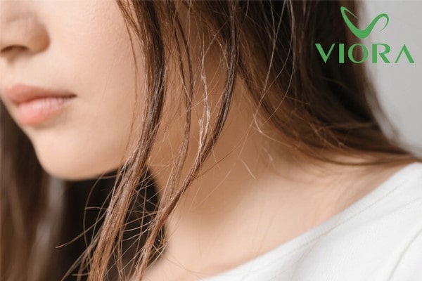 Tóc bị khô và chẻ ngọn: Nguyên nhân và giải pháp giúp phục hồi hiệu quả 13 Tóc bị khô và chẻ ngọn: Nguyên nhân và giải pháp giúp phục hồi hiệu quả