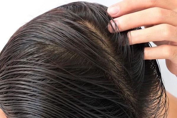 Vì Sao Tóc Nhanh Bết? Nguyên Nhân Và Cách Khắc Phục Hiệu Quả 9 Vì Sao Tóc Nhanh Bết? Nguyên Nhân Và Cách Khắc Phục Hiệu Quả