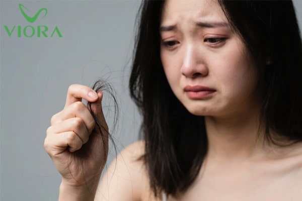 Rụng tóc nhiều là dấu hiệu của bệnh gì? Đừng chủ quan với triệu chứng tưởng như bình thường 25 Rụng tóc nhiều là dấu hiệu của bệnh gì? Đừng chủ quan với triệu chứng tưởng như bình thường