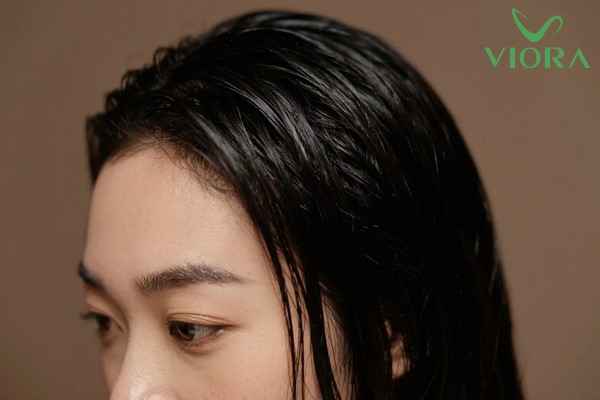 Nguyên nhân tóc bết dầu và cách khắc phục hiệu quả 3 Nguyên nhân tóc bết dầu và cách khắc phục hiệu quả 2