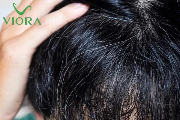 Tóc Bạc Từ Gốc Hay Ngọn? Sự Thật Về Quá Trình Bạc Tóc 13 Tóc Bạc Từ Gốc Hay Ngọn? Sự Thật Về Quá Trình Bạc Tóc