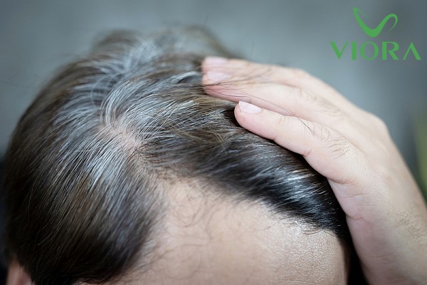 Tóc Bạc Từ Gốc Hay Ngọn? Sự Thật Về Quá Trình Bạc Tóc 2