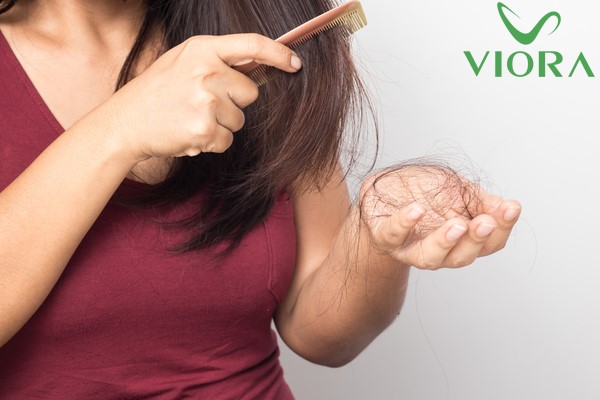 Tóc vuốt nhẹ đã rụng có phải là dấu hiệu tóc đã hư tổn nặng? 4 Tóc vuốt nhẹ đã rụng có phải là dấu hiệu tóc đã hư tổn nặng? 3