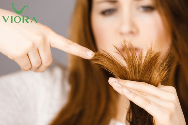 Dầu gội giảm khô xơ chẻ ngọn cho tóc là gì? Thành phần như thế nào? 3 Dầu gội giảm khô xơ chẻ ngọn cho tóc là gì? Thành phần như thế nào? 2
