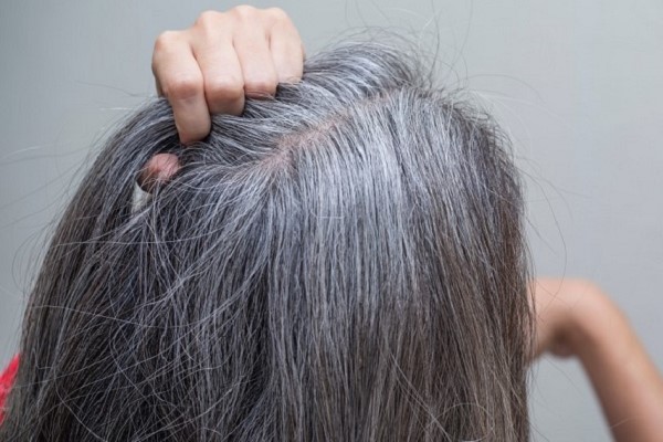 Máu xấu tóc bạc: Hiểu đúng nguyên nhân và cách chăm sóc sức khỏe