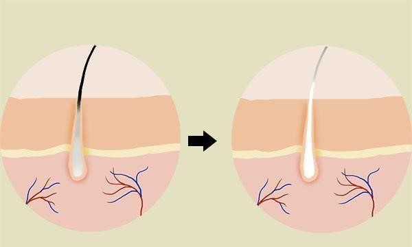 Máu xấu tóc bạc: Hiểu đúng nguyên nhân và cách chăm sóc sức khỏe 2