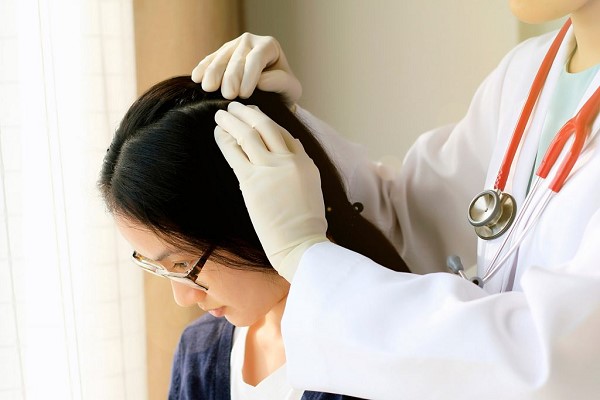 Thuốc Trị Nấm Tóc - Giải Pháp Hiệu Quả Cho Da Đầu Khỏe Mạnh 3 Thuốc Trị Nấm Tóc - Giải Pháp Hiệu Quả Cho Da Đầu Khỏe Mạnh 3