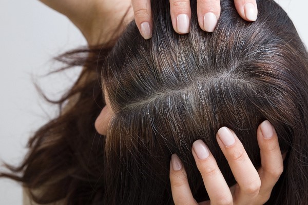 Tóc Bạc Sớm Ở Nữ Nên Uống Gì? Giải Pháp Giúp Lấy Lại Mái Tóc Đen Mượt 2 Tóc Bạc Sớm Ở Nữ Nên Uống Gì? Giải Pháp Giúp Lấy Lại Mái Tóc Đen Mượt 2