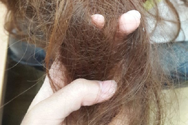 Tóc Khô Xơ Như Rơm Làm Thế Nào Để Phục Hồi? 2 Tóc Khô Xơ Như Rơm Làm Thế Nào Để Phục Hồi? 2