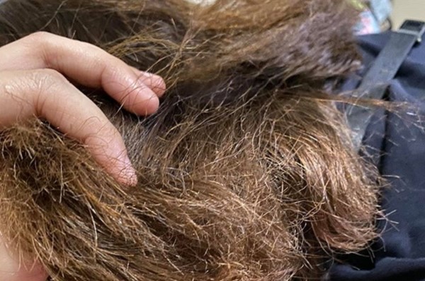 Tóc Khô Xơ Như Rơm Làm Thế Nào Để Phục Hồi? 3 Tóc Khô Xơ Như Rơm Làm Thế Nào Để Phục Hồi? 3