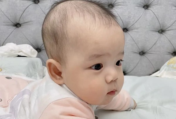 Trẻ sơ sinh rụng tóc có sao không? Nguyên nhân và chăm sóc đúng cách 2 Trẻ sơ sinh rụng tóc có sao không? Nguyên nhân và chăm sóc đúng cách 2