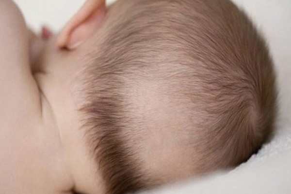Trẻ Bị Rụng Tóc Vành Khăn Nên Uống Gì? 3 Trẻ Bị Rụng Tóc Vành Khăn Nên Uống Gì? 3