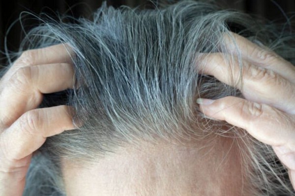 Hà Thủ Ô Trị Tóc Bạc Được Không? Sự Thật Về Hà Thủ Ô Và Chăm Sóc Tóc Bạc 1