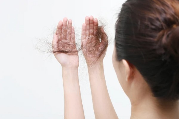 Mùa Rụng Tóc Có Đáng Lo Không? Cách Ngăn Ngừa Và Chăm Sóc Tóc Hiệu Quả
