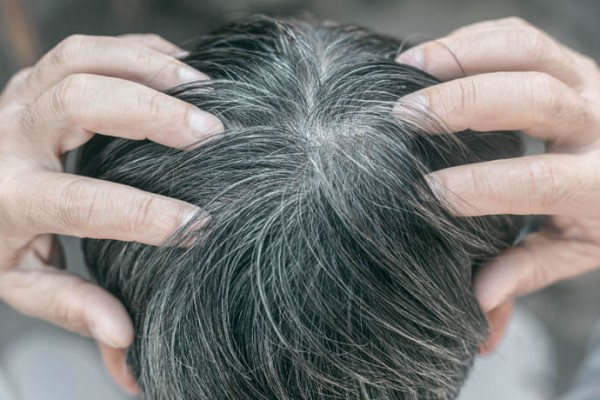 Tại Sao Lại Có Tóc Bạc? Nguyên Nhân Và Giải Pháp Chăm Sóc Tóc