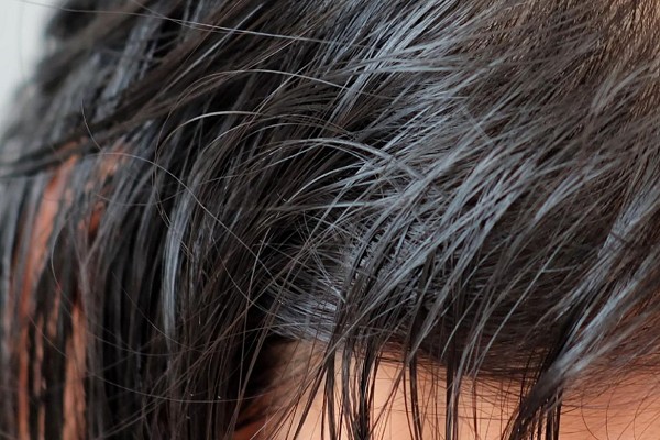 Tóc Bết Là Gì? Nguyên Nhân và Cách Khắc Phục Hiệu Quả