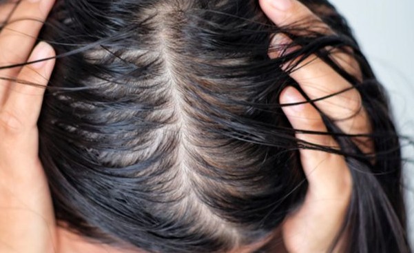 Tóc Bết Là Gì? Nguyên Nhân và Cách Khắc Phục Hiệu Quả 2 Tóc Bết Là Gì? Nguyên Nhân và Cách Khắc Phục Hiệu Quả 2