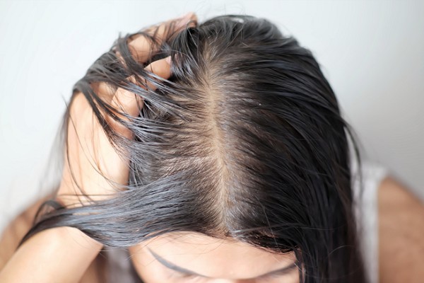 Tóc Bết Là Gì? Nguyên Nhân và Cách Khắc Phục Hiệu Quả 3 Tóc Bết Là Gì? Nguyên Nhân và Cách Khắc Phục Hiệu Quả 3