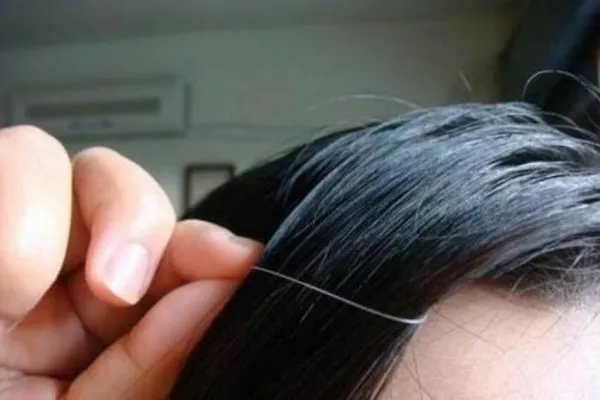 Tác Hại Của Việc Nhổ Tóc Bạc - Cảnh Báo Từ Chuyên Gia Da Liễu