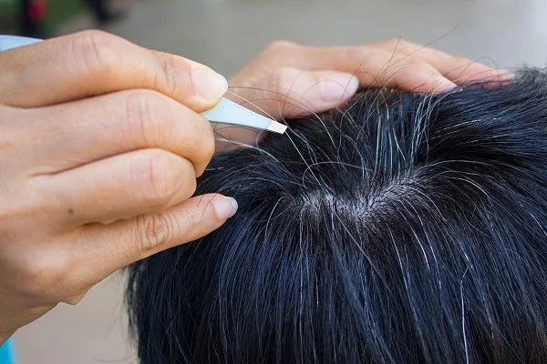 Tác Hại Của Việc Nhổ Tóc Bạc - Cảnh Báo Từ Chuyên Gia Da Liễu 2