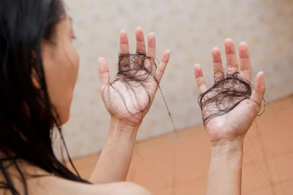Tóc rụng 30 sợi một ngày có đáng lo ngại? Nguyên nhân và cách khắc phục
